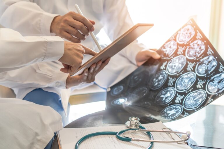 Doctors look at a neurological scan.