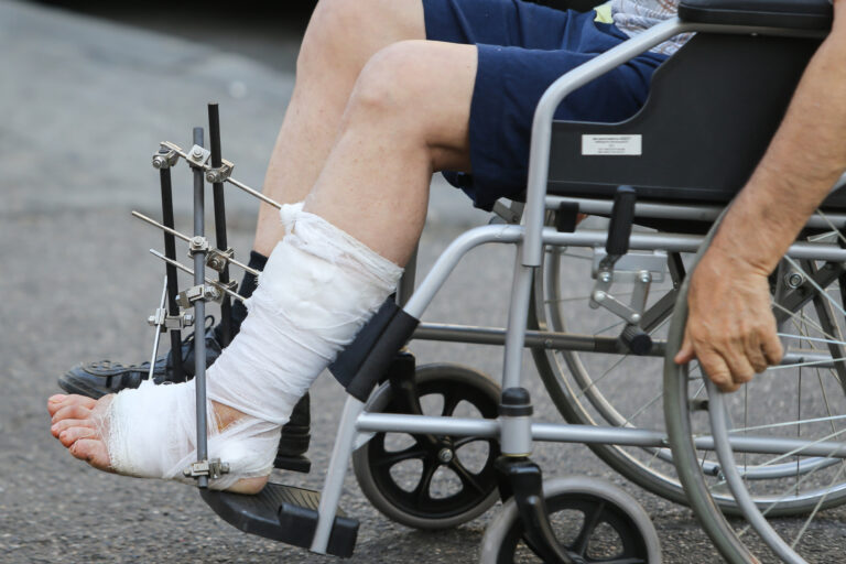 A man in a wheelchair with his leg in a cast after suffering further harm after a medical professional missed his fracture.