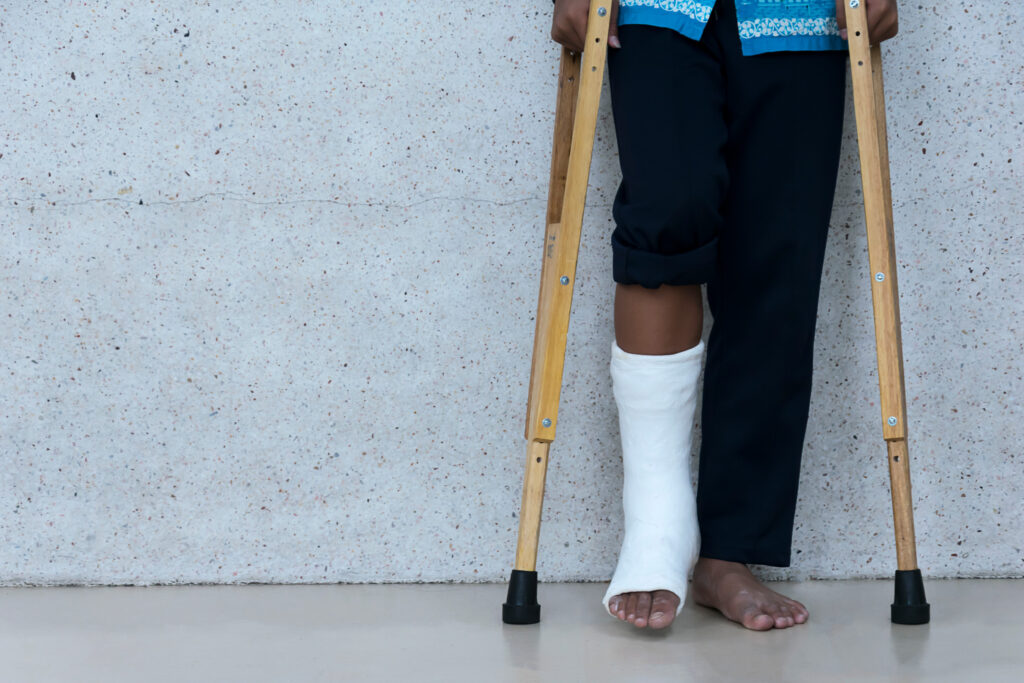 A person stands using crutches, their leg is in a cast.